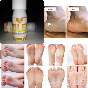 Crème anti-callosité des pieds et des mains