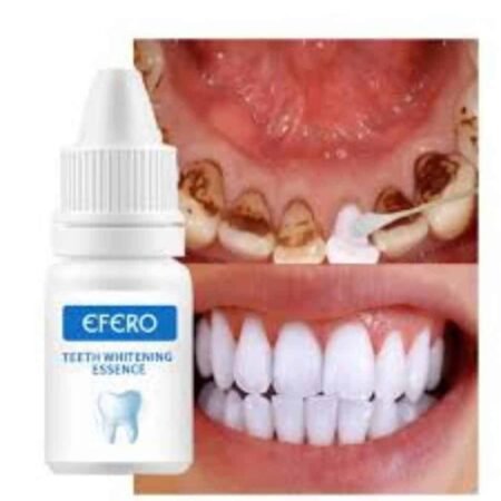 EFERO Sérum Blanchissant Dents Efficace, Essence Dentaire Anti-Taches pour un Sourire Éclatant, Traitement Éclaircissant Rapide et Doux pour Dents Jaunies et Tachées