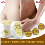 pasjel creme pour les vergetures et le deplacement