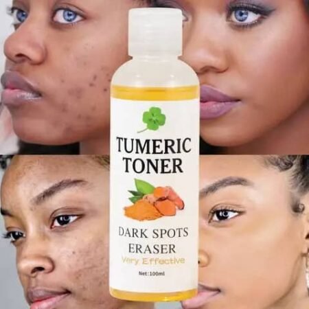 TONER huile de visage au tumeric contre les boutons et taches