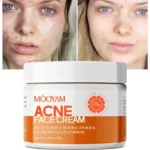 creme pour le visage de l acne mooyam anti acne