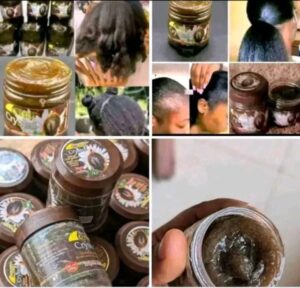 Pommade pousse cheveux