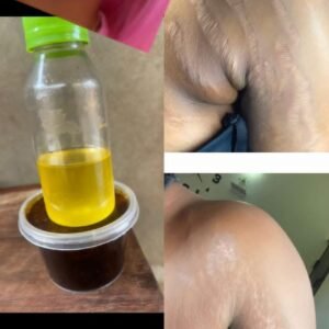 Kit huile et savon anti vergetures