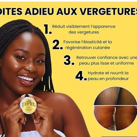 Crème pastel anti vergetures, acné bouton