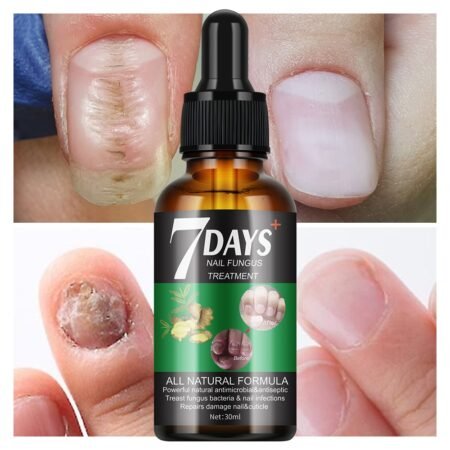Sérum fortifiant réparateur pour ongles abîmé et infectés