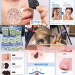 Pince à fleur ð¸ hibiscus