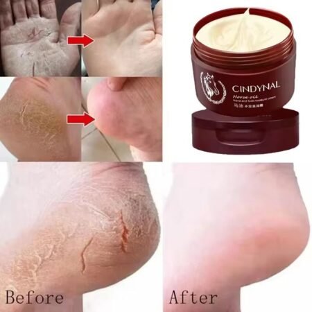Crème Réparatrice Mains et Pieds CINDYNAL à l'Huile de Cheval, Soin Hydratant Intense Anti-Crevasses et Anti-Gerçures pour Peau Sèche et Abîmée, Adoucit et Lisse la Peau