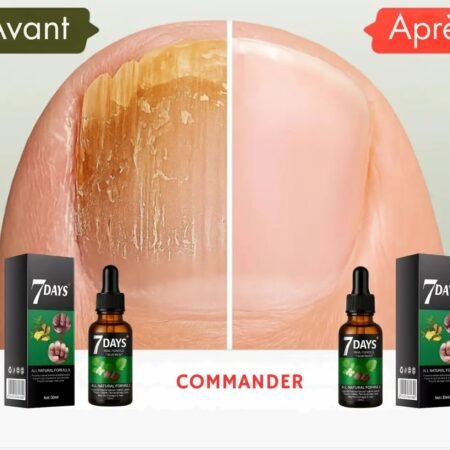 Sérum Traitement Mycoses Ongles 7 Jours, Solution Antifongique Naturelle pour Réparer et Restaurer les Ongles Abîmés, Fortifiant et Protecteur Contre les Champignons, Formule Rapide 30ml