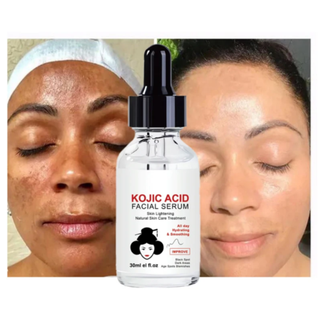 Sérum Visage Acide Kojique Éclaircissant et Anti-Taches, Traitement Naturel Hydratant et Lissant pour Peau Unifiée, Réduit Taches Brunes et Hyperpigmentation (30ml)