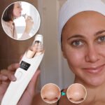 Aspirateur point noir 1