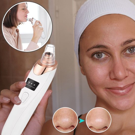 Aspirateur point noir 1 Aspirateur point noir 1