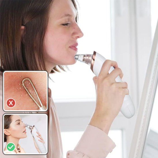 Aspirateur point noir 4 Aspirateur point noir 4